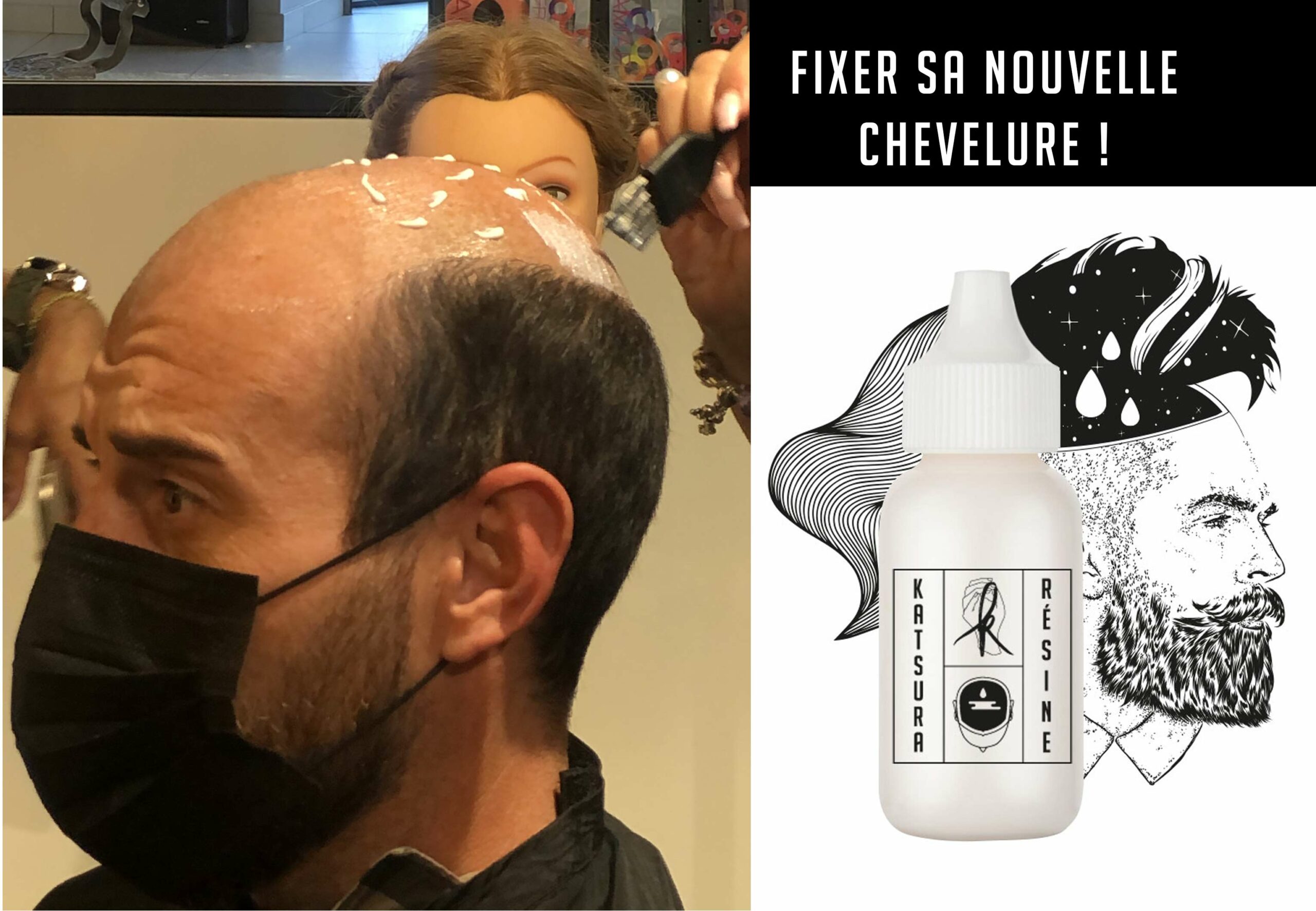 Fixer sa prothèse capillaire avec les colles du marché de perruques ! blog fixation colle resine complement capillaire perruque katsura scaled