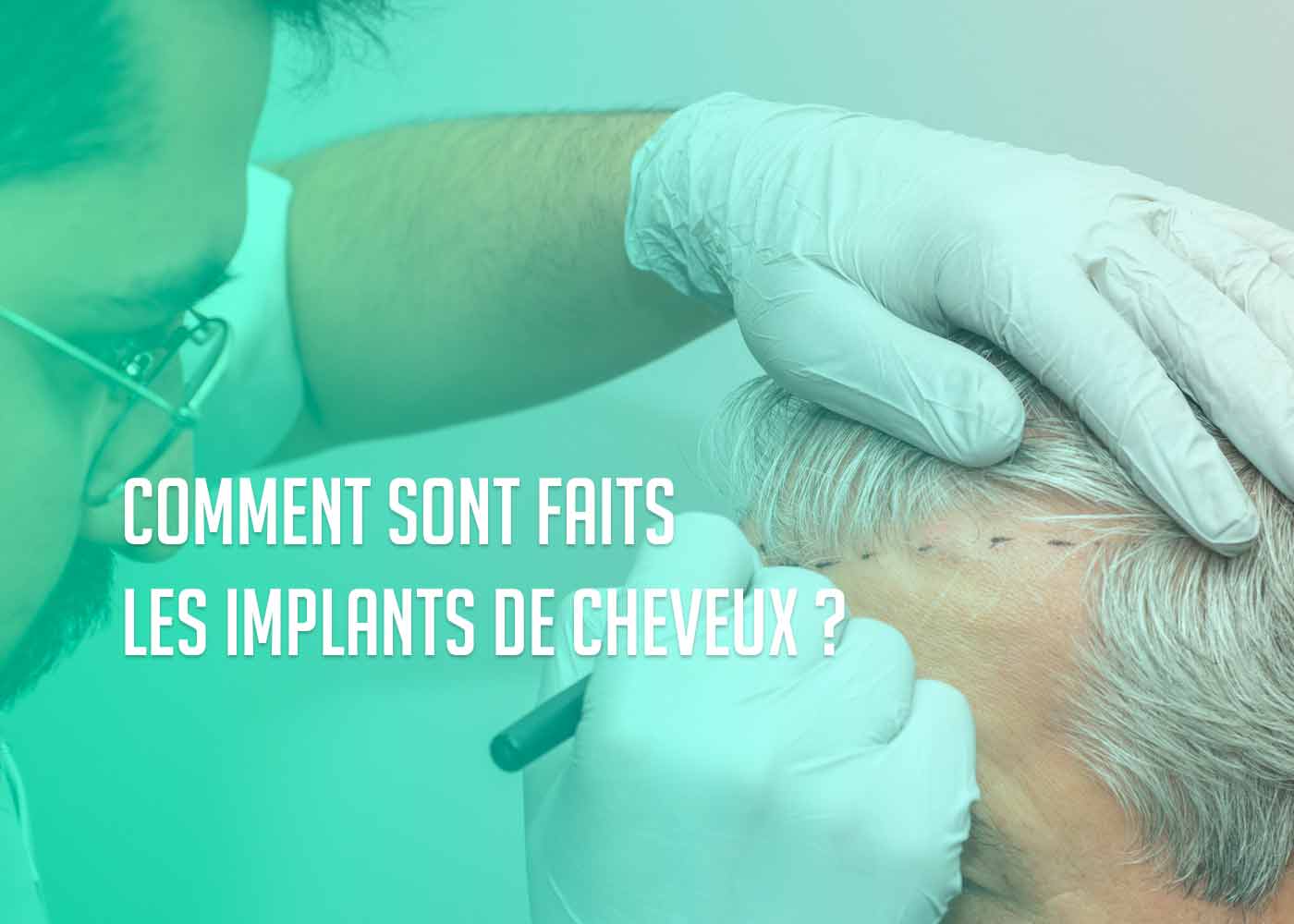 Comment sont faits les implants de cheveux ? comment sont fait implants capillaires