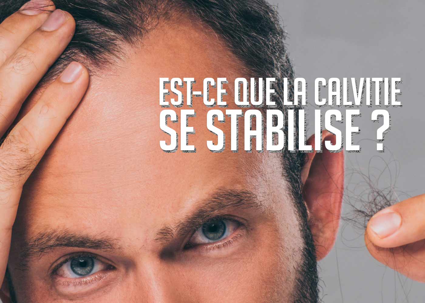 est_ce_que_la_calvitie_se_stabilise