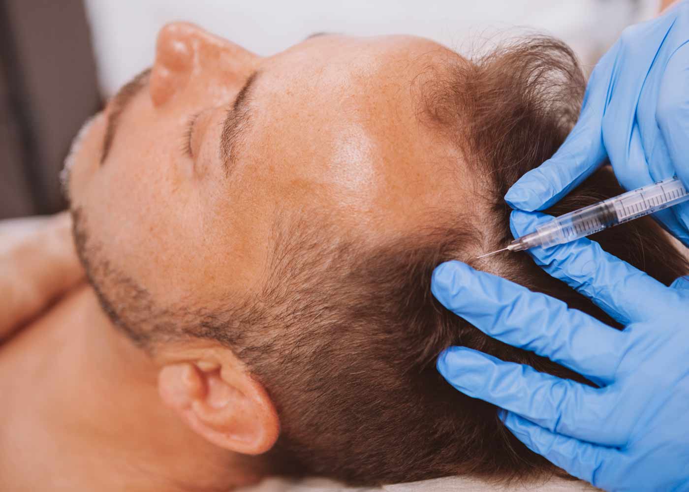 traitement injection stimulation pousse cheveux