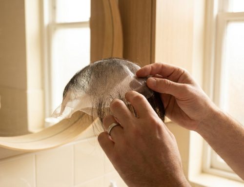 Pose prothèse capillaire homme : le guide étape par étape
